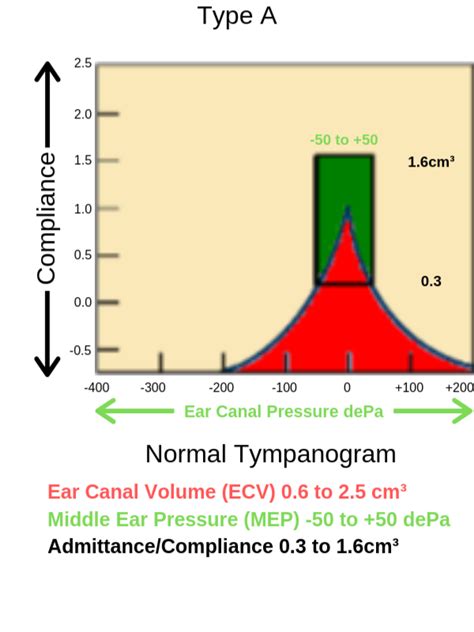 tympanogram type ad|tympanogram y axis is ear canal volume.